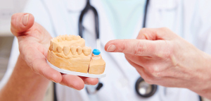 What is dental crowns?